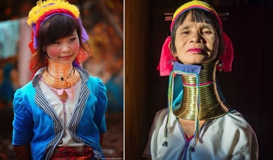 Trào lưu làm đẹp kinh dị: Để lông nách dài, nhổ răng cửa, căng tai... mới là