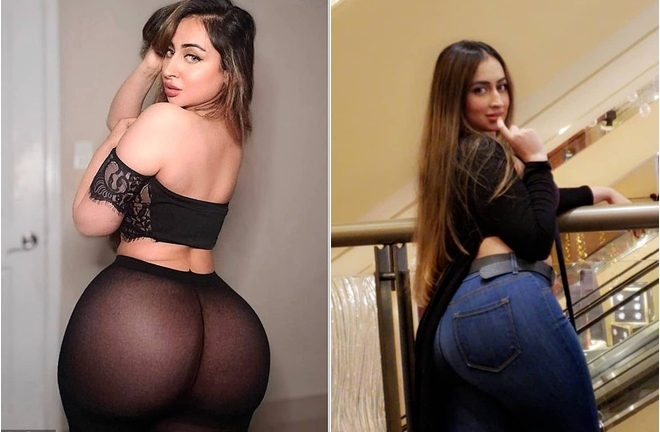 Nữ người mẫu không thể ngồi 6 tháng vì phẫu thuật vòng 3 