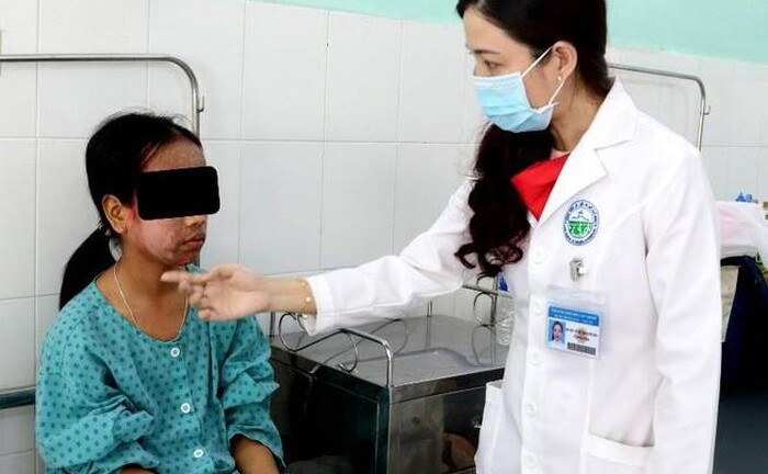 Da mặt thiếu nữ 17 tuổi 