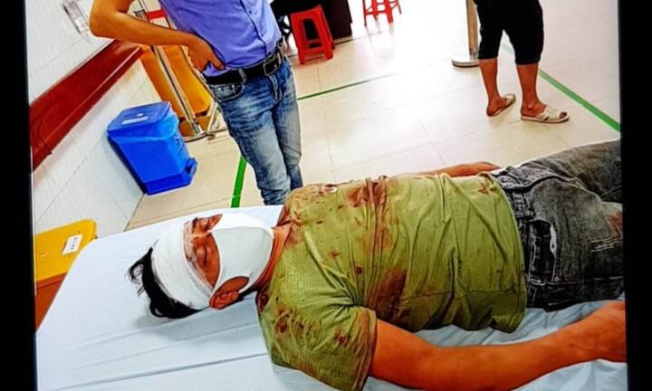 Yên Phong – Bắc Ninh: Kỳ án nhiều vết thương chằng chịt ở đầu chỉ 3% thương tích