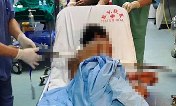 Sơ suất khi đào giếng, nam công nhân bị xà-beng dài 1m đâm thấu ngực