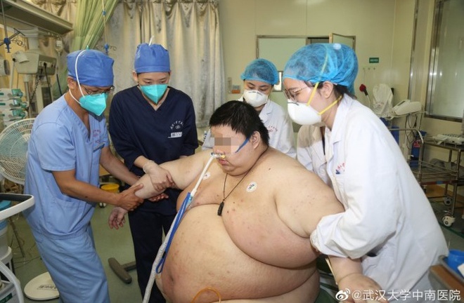 Tăng 100kg sau 5 tháng cách ly, chàng trai 26 tuổi phải cầu cứu bác sĩ