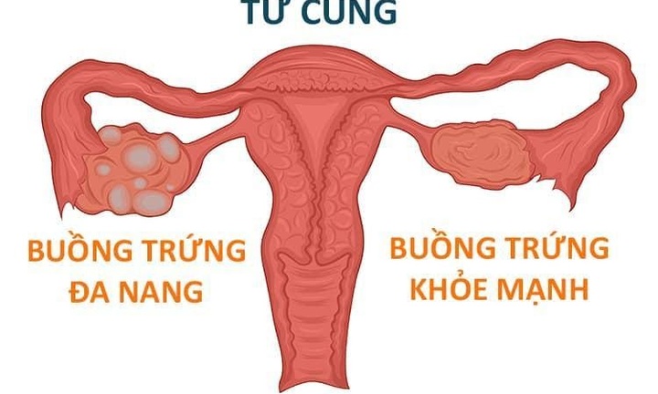 Mách bạn 6 lợi ích sức khỏe của nguồn nước hoàn nguyên Nhật Bản
