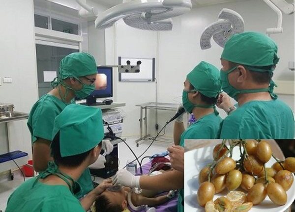 Hóc hạt quất hồng bì, bé trai 7 tuổi suýt mất mạng