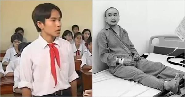 Những dấu hiệu nhận biết ung thư hạch sớm, chớ bỏ qua kẻo hối hận không kịp