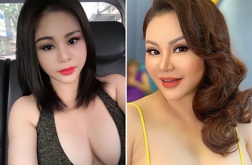 Sở hữu ngoại hình trẻ trung căng đầy sau 20 lần