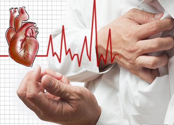Dấu hiệu nhật biết và cách điều trị nhồi máu cơ tim cấp