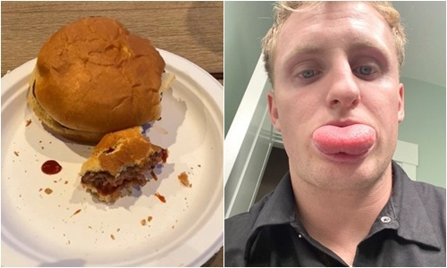 Đang ăn bánh mì bị con vật bé nhỏ này tấn công, người đàn ông 