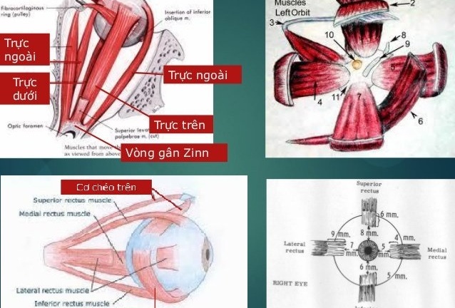 Phương pháp chữa mắt lác (mắt lé) bằng đông y