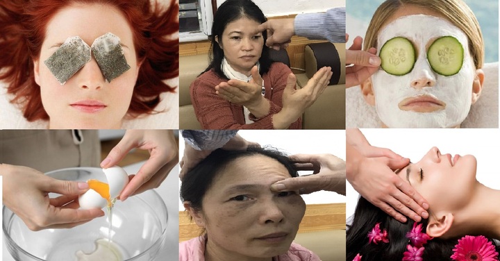 Bài tập cho mắt sụp mí tại nhà có thực sự hiệu quả?