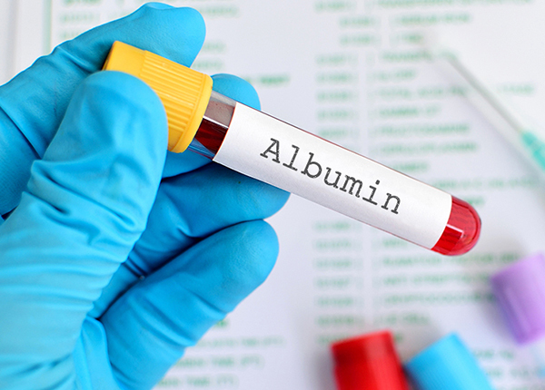 Cùng Bác sĩ Dược Sài Gòn tìm hiểu về vai trò của Albumin trong cơ thể