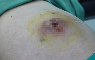 Tin tức đời sống ngày 20/2: Mất cơ hội làm mẹ sau khi chữa u xơ ở phòng khám tư