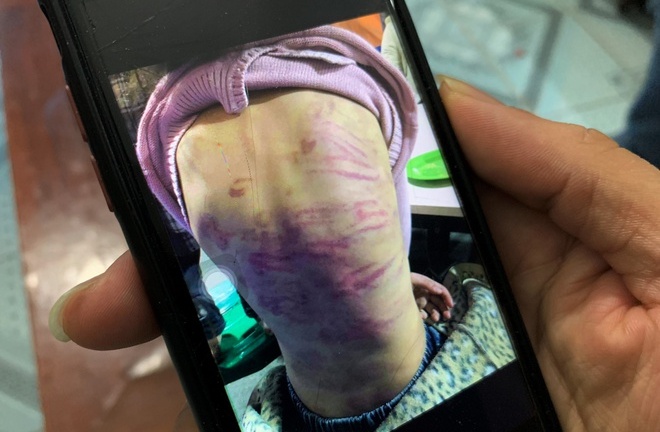 Tin tức pháp luật mới nhất ngày 20/2: Làm rõ nghi án bé gái 12 tuổi bị bạo hành, xâm hại tình dục