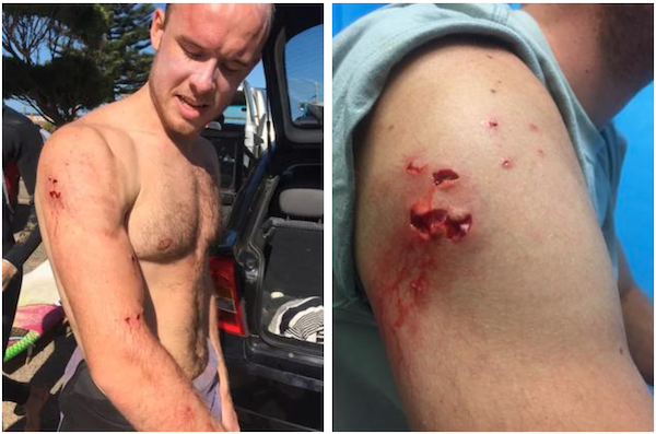 Bác sĩ thoát chết khi bị cá mập