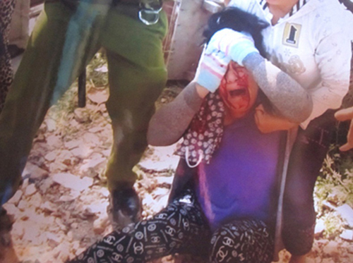 Chánh Thanh tra Sở Y tế 