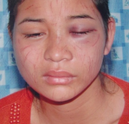 Thông tin mới nhất vụ chồng dã man bắt vợ tự rạch mặt, cắt tóc