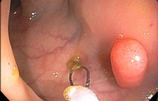 Bệnh ung thư - Nhận biết, dự phòng và chiến thắng