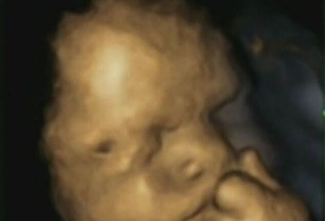 Thai nhi chống cằm suy tư khi mẹ bầu căng thẳng