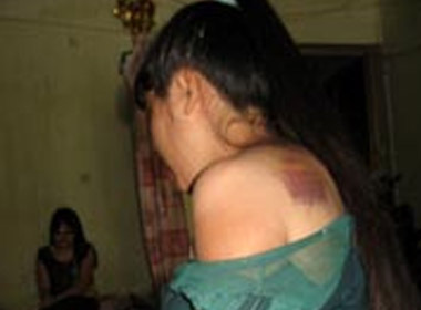 Cô gái mù bị