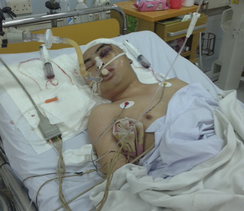 Điều tra vụ CSGT Hòa Bình gây chấn thương nặng cho nam thanh niên