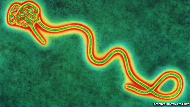 Mỹ xác nhận ca nhiễm virus Ebola đầu tiên ngoài châu Phi