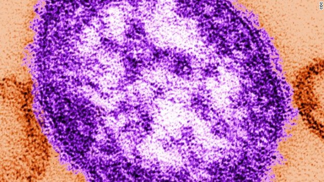 Dịch sởi tồi tệ nhất trong 20 năm bùng phát tại Mỹ