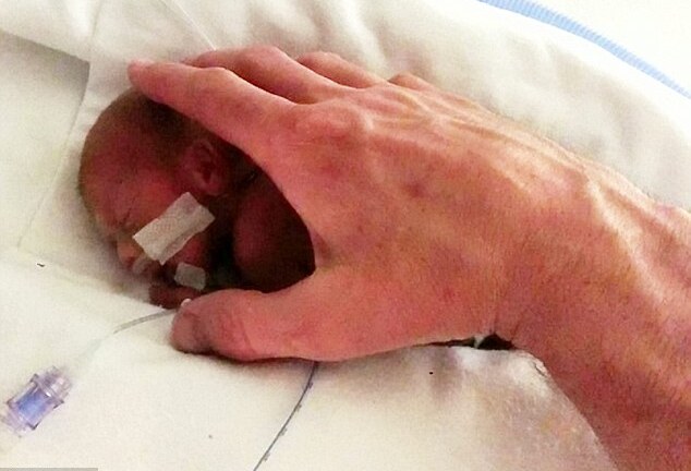 Kỳ diệu bé trai 20 tuần sống sót vì mẹ không nghe theo bác sĩ