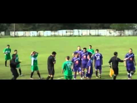 Rút thẻ đỏ, trọng tài bị cầu thủ húc đầu đến vỡ mũi