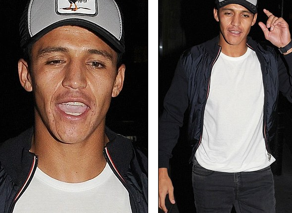 Alexis Sanchez bay đêm với rượu ăn mừng bàn thắng