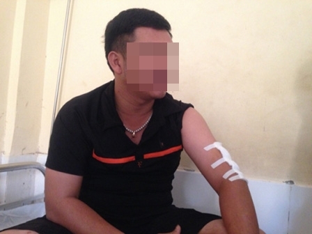 Nghi án CSGT chém cán bộ trại giam: Xuống tay vì bị 