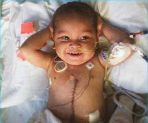 Bé trai phục hồi kỳ diệu sau khi cấy ghép 5 cơ quan nội tạng