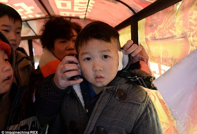 Ghép lại đôi tai của cậu bé 6 tuổi bị bà thím ác độc cắt bỏ 