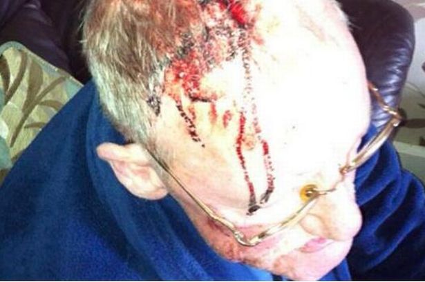 Chấn động bệnh nhân dùng búa đánh chảy máu đầu bác sĩ