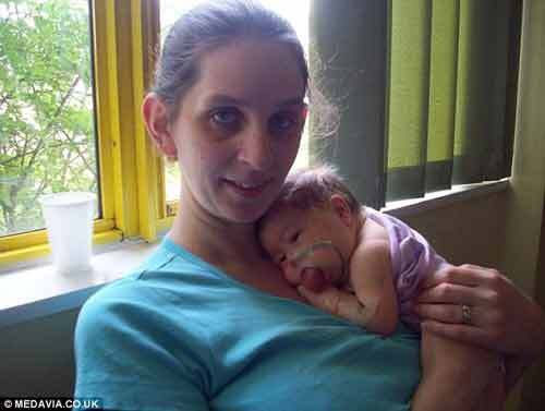 Bé gái Anh mắc chứng lưỡi to đáng sợ sắp đi học