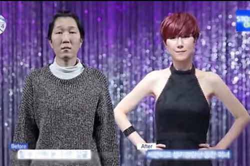 Hành trình “lột xác” của một phụ nữ xấu xí nhờ phẫu thuật thẩm mỹ