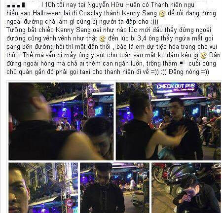 Sự thật vụ chàng trai hóa trang thành Kenny Sang bị đánh bầm dập