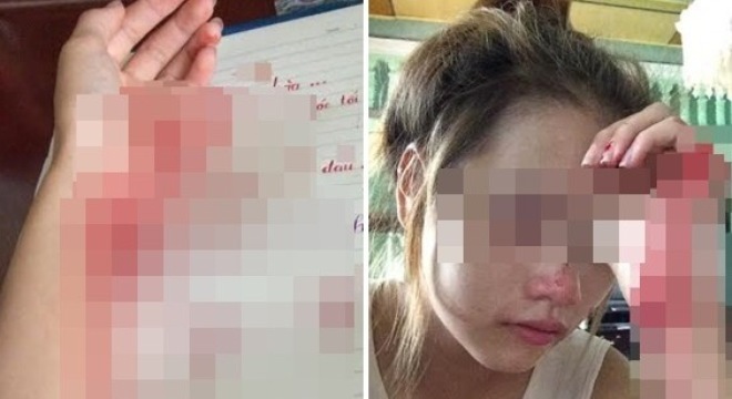 Nữ sinh Hải Phòng rạch tay vì 