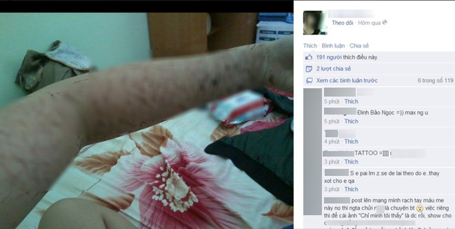 Rùng mình cảnh nữ sinh Bình Dương rạch tay chi chít