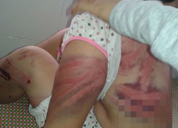 Phẫn nộ chồng tra tấn vợ dã man như thời trung cổ