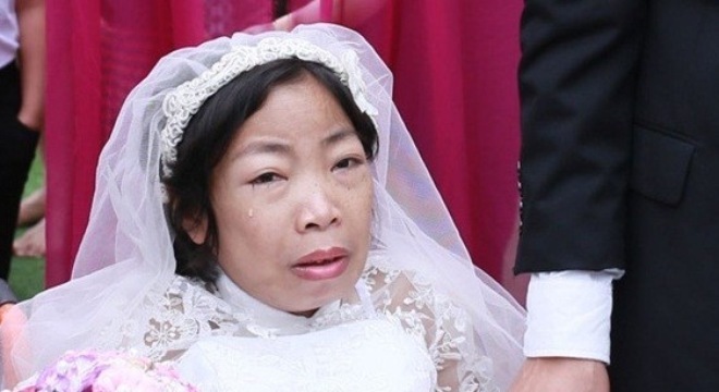 Những ngày cuối đời đau đớn của cô gái suy thận 