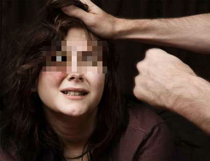 Chồng là cán bộ nhà nước vẫn đánh vợ