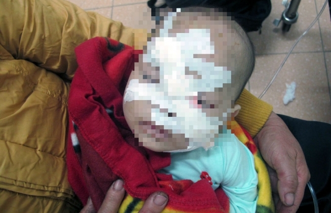 Khởi tố em rể truy sát chị vợ, chém trọng thương cháu 6 tháng