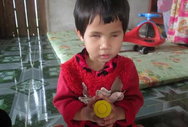 Ước mơ được nô đùa của bé 3 tuổi mắc bệnh teo nhãn cầu