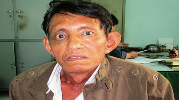 Bắt khẩn cấp kẻ giết người sau va chạm giao thông