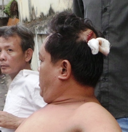 Côn đồ náo loạn khu dân cư, đánh tím mắt cụ ông 84 tuổi