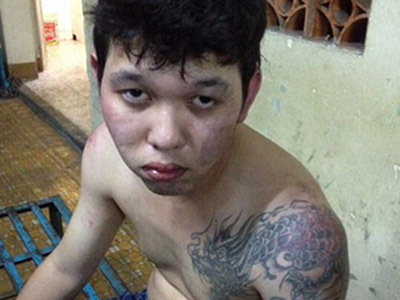 Kẻ trộm táo tợn dùng dao đâm công an để tẩu thoát