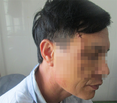 Nam thanh niên “điên tình” chém trọng thương bố người yêu