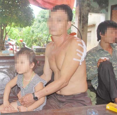 Bị làm nhục, gã trai vác mã tấu truy sát, 3 cha con thương vong