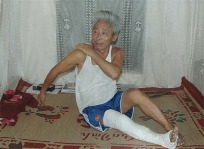Bị đốt gara, đánh gãy chân vì chống tham nhũng?