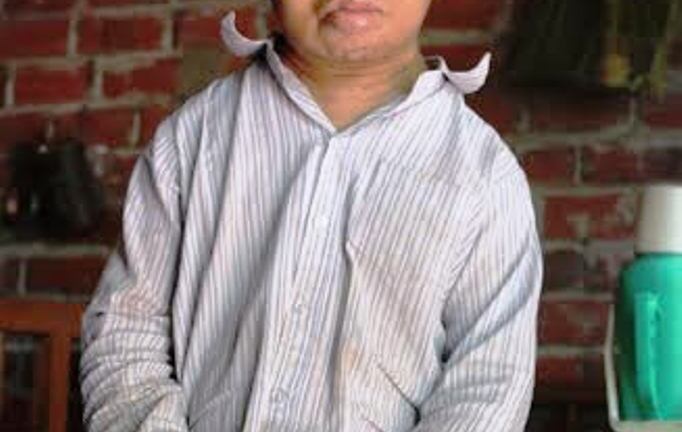 Người đàn ông U50 trong hình hài đứa trẻ lên 10